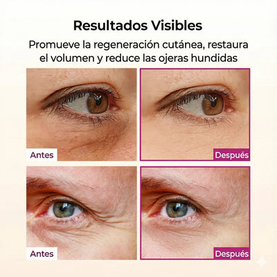 Haz que tu mirada se vea más fresca y descansada
